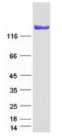 SDS-PAGE (HDLBP-1917HFL).jpg